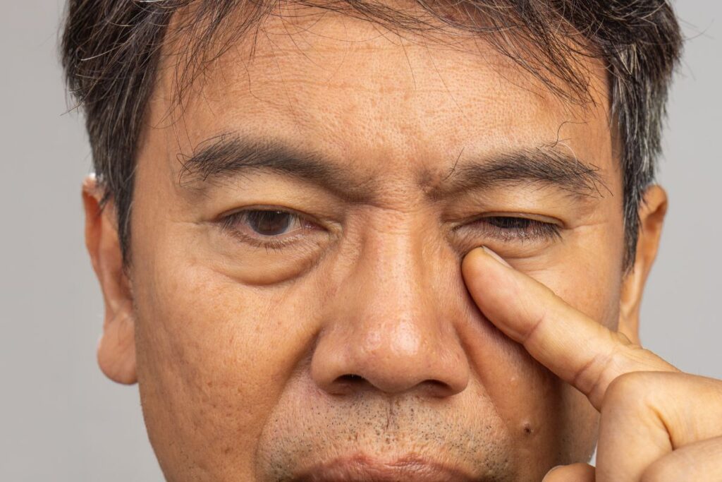 when to worry about eye twitching